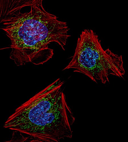 2013-5-burnette-mouse-fibroblasts-large-file